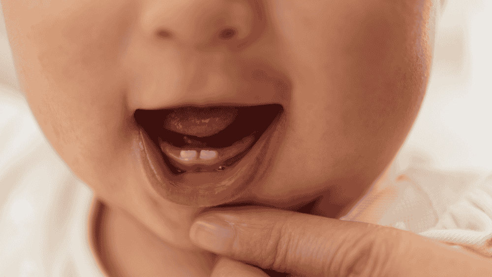 Niño mostrando sus dos dientes natales